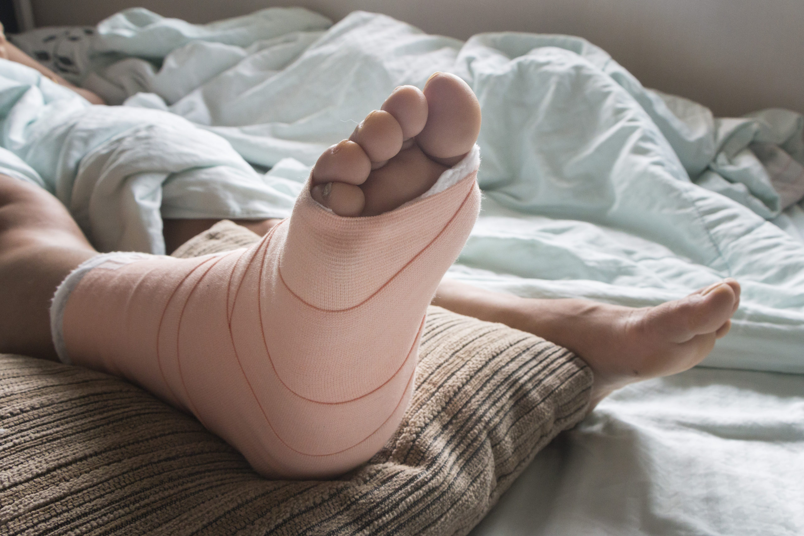 Compensation for Personal Injury Victims - foot in cast in hospital bed