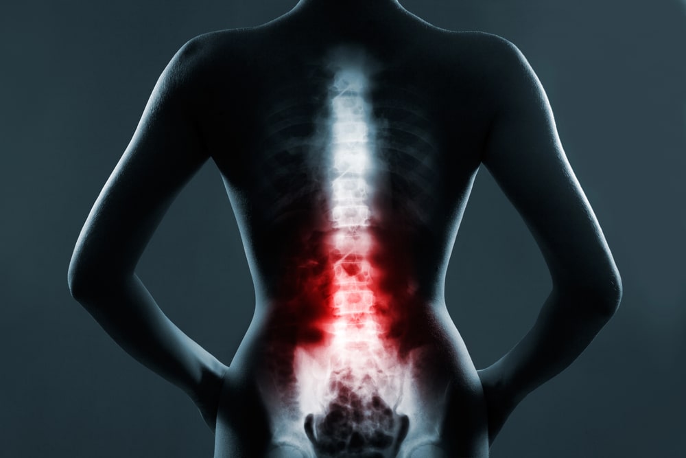 Iowa spinal cord injury attorney