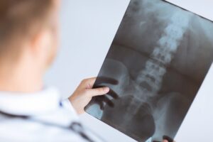 Clive Personal Injury Lawyer FAQs